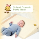 Solusi Gumoh pada Bayi